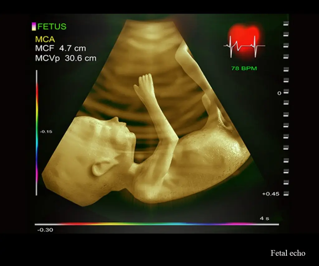 Fetal echocardiography